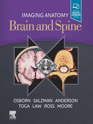 cover image of Imaging Anatomy Brain and Spine, E-Book